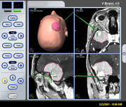 Brain Hemorrhage Conditions - Immediate Care at Dr. Gupte’s Clinic