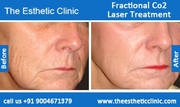 Fractional Co2 Skin Resurfacing Treatment in Mumbai