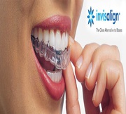 Get Invisalign Treatments Through Invisible Braces in Mumbai