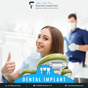 Best dental Implant treatment In Pune